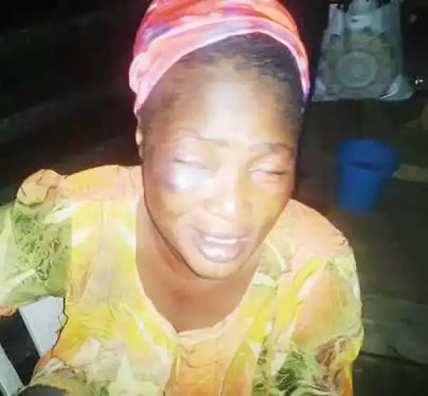 Man Batters His Wife In Lagos Over Missing N2,000 (Photo)